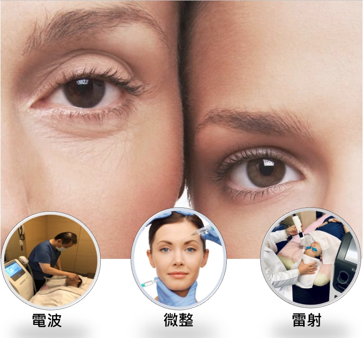明眸媚眼30秒迷倒眾生！完美眼周療程解密
